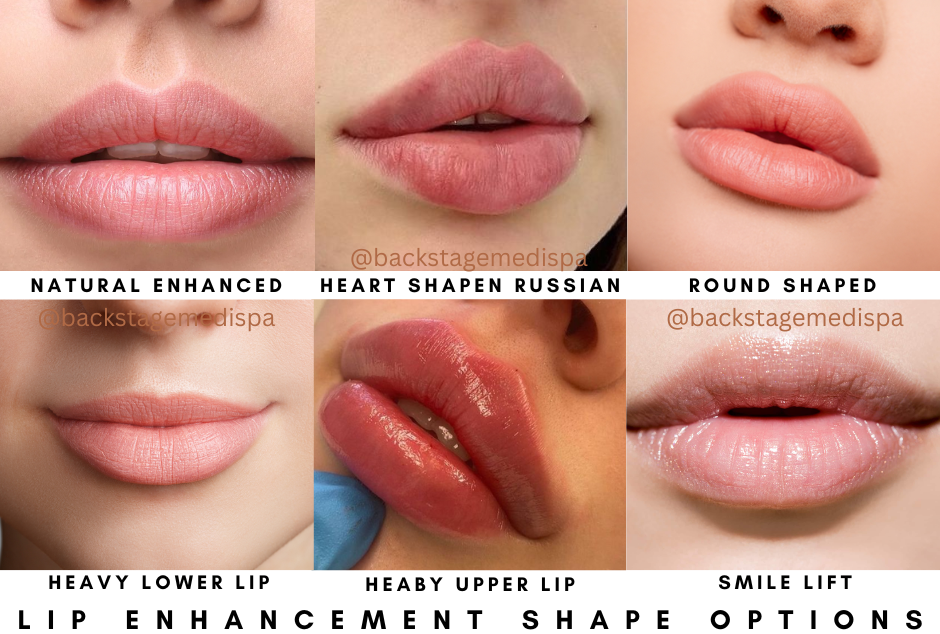 Lip Shape & Enhancement