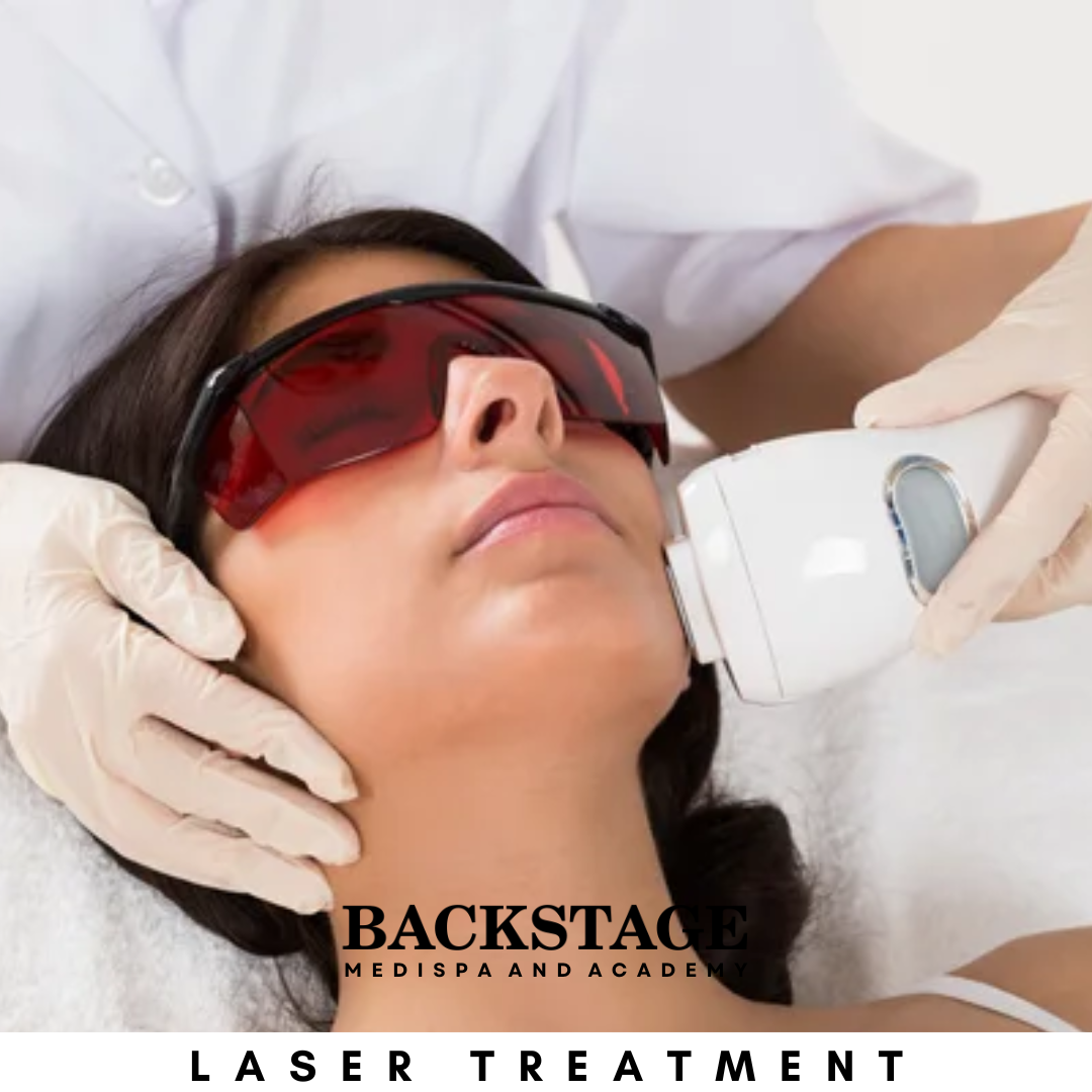 laser treatment for acne model town delhi